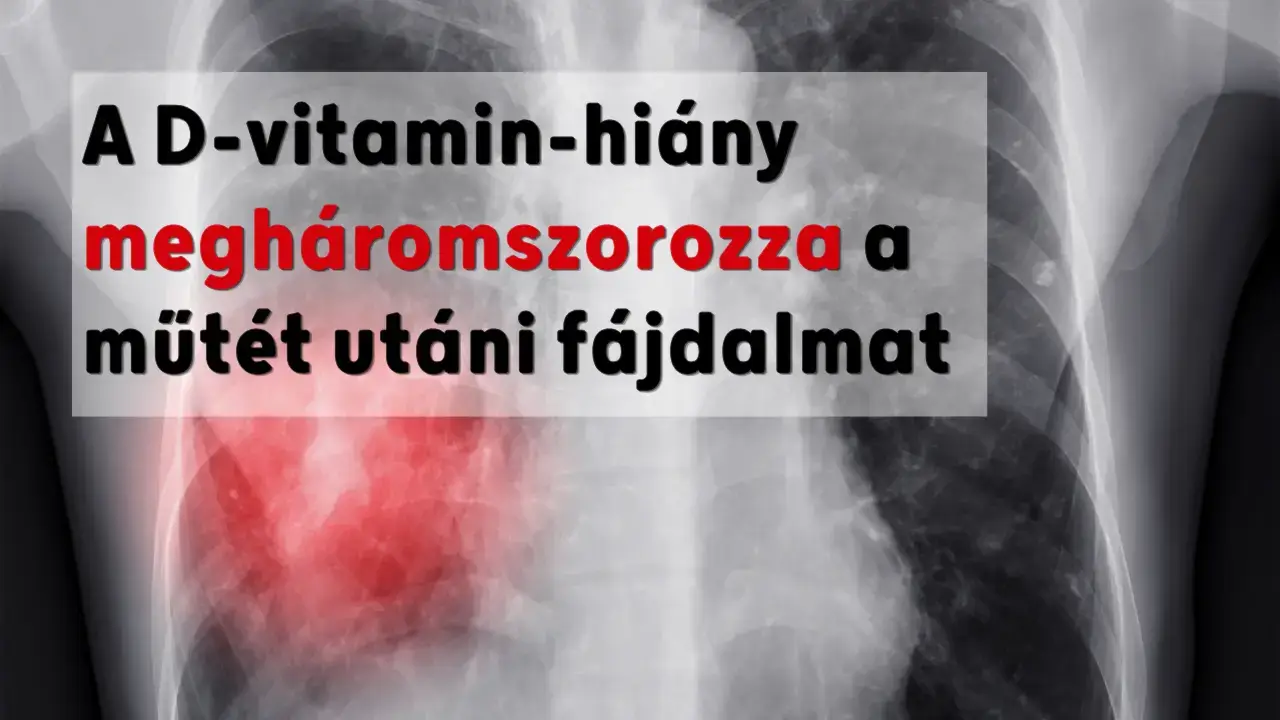 A D-vitamin-hiány megháromszorozza a műtét utáni fájdalmat